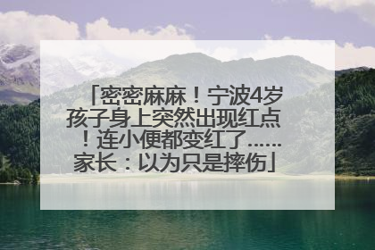 密密麻麻！宁波4岁孩子身上突然出现红点！连小便都变红了……家长：以为只是摔伤
